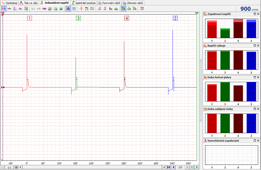 Analyza MTPro Sekundarni napeti.jpg